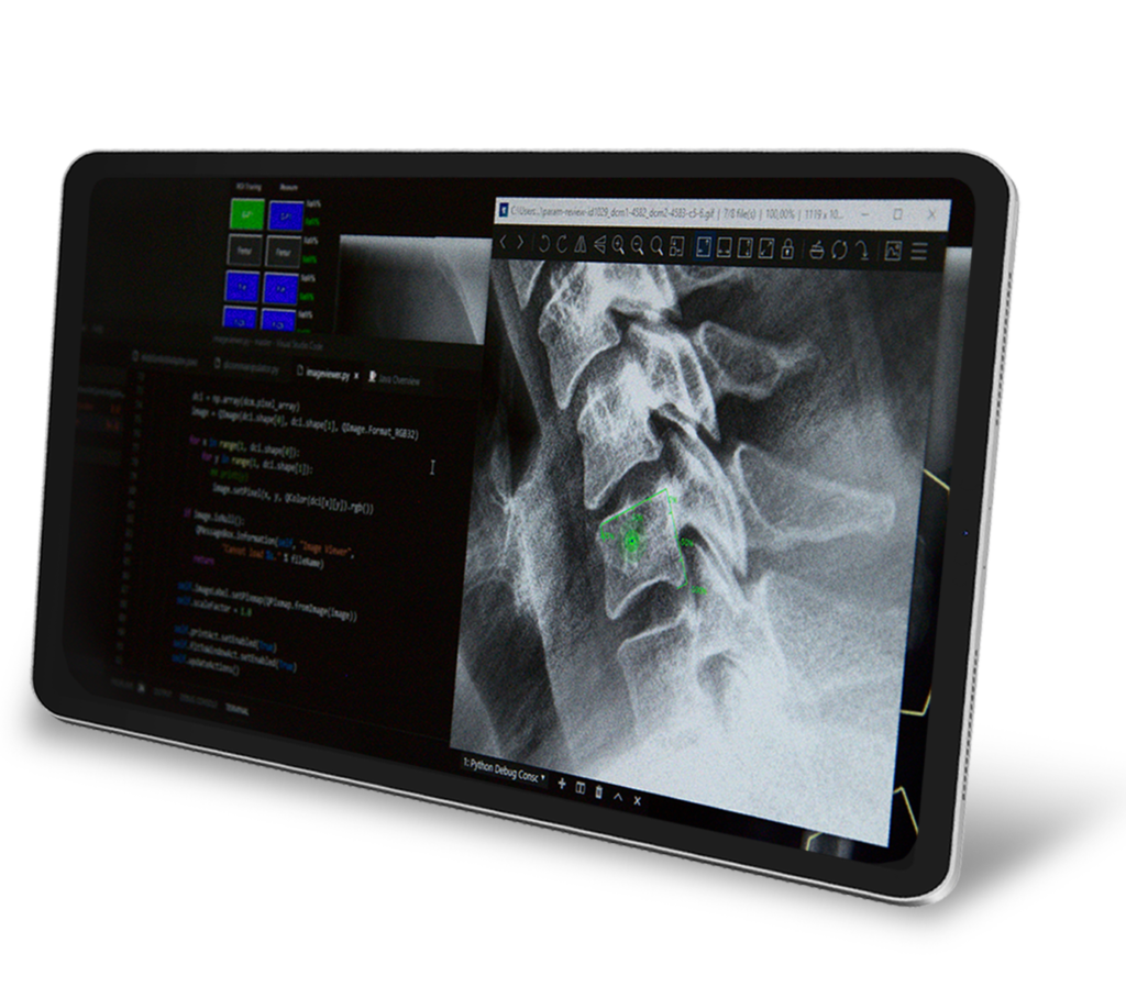 Imaging Core Lab Services by RAYLYTIC