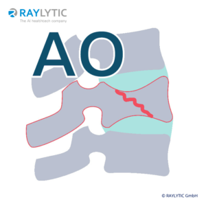 AO fracture classification - Spinal parameters