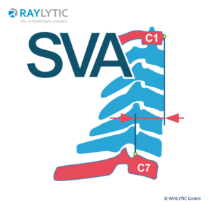 C1-C7 sagittal vertical axis - Spinal parameters