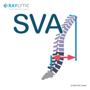 Sagittal vertical axis (SVA) - Spinal parameters
