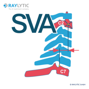 C2-C7 sagittal vertical axis - Spinal parameters