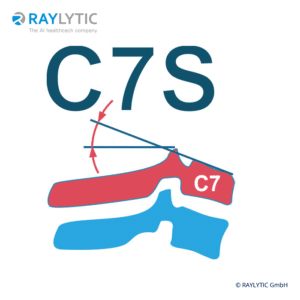 C7 Slope- Spinal parameters