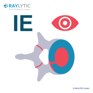 Evaluation extravision - Spinal parameters