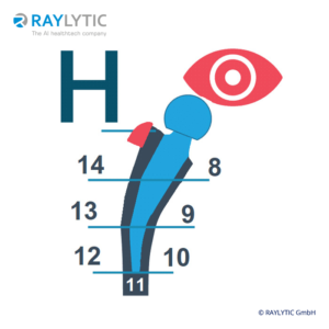 Evaluation of hypertrophy - Pelvic parameters