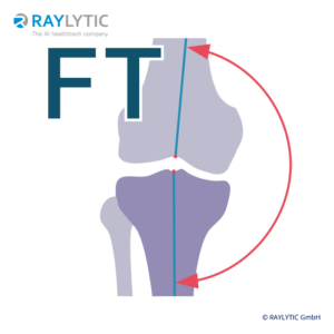 mFAmTA (Hip-Knee-Ankle-Angle (femoro-tibial angle)) - Full leg parameters