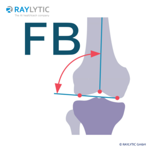 mLDFA (Mechanical lateral distal femoral angle) - Full leg parameters