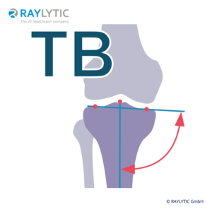 mMPTA (Mechanical medial proximal tibial angle) - Full leg parameters