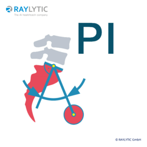 Pelvic incidence (PI) - Spinal parameters