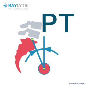 Pelvic tilt (PT) - Spinal parameters