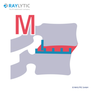 Spondylolisthesis acc. to Meyerding (%) .